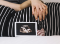 #PraTodosVerem: Na foto uma mulher grávida está usando um vestido listrado preto e branco, com sua mão e uma outra mão, repousadas na barriga e uma foto de um ultrassom gestacional apoiado na barriga.