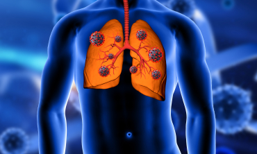 #PraTodosVerem: Imagem representativa em fundo azul de um corpo humano com destaque para o pulmão. 